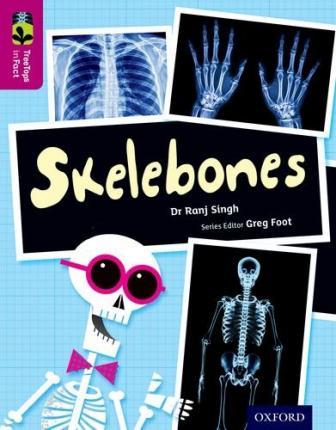 Oxford Reading Tree TreeTops inFact: Level 10: Skelebones - Ranj Singh